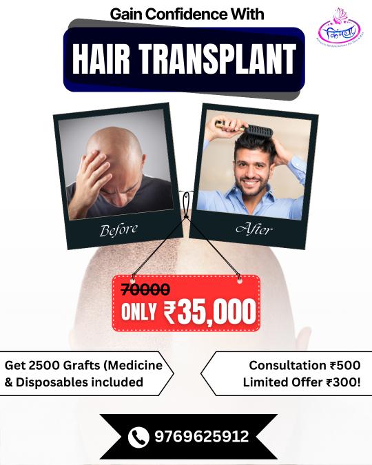 Hair transplant